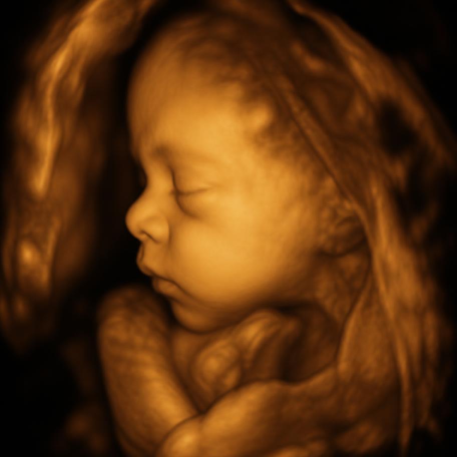4D ultrahangfelvétel: a baba arcéle