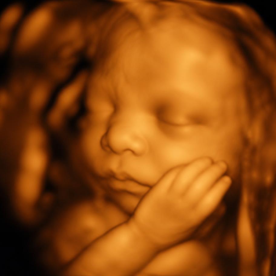 4D ultrahangfelvétel a privát galériából: a baba arca